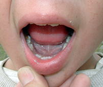 �����S���̏��̎q